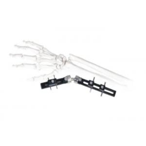 Straight Pin Type Wrist Medical External Fixator minimal interference with soft-tissue
