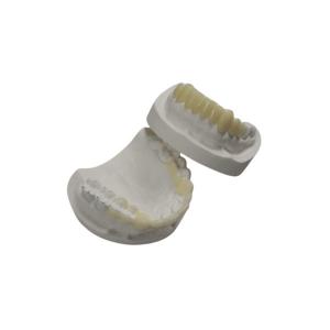 Custom TEMP Porcelain Tooth Crown Inlay Onlay Strong Hardness Veneer