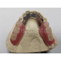 China OEM Flexible Removable Partial Denture  Easy To Clean / Maintain on sale