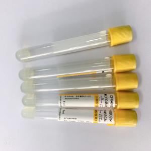Professional Serum Clot Activator Tubes Separation Yellow Cap vacuum blood colletion tube