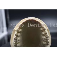 China High Strength Artificial Teeth Veneers Dentist Porcelain Veneers Natural Looking on sale