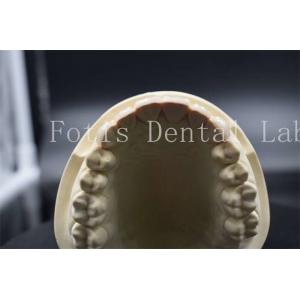 High Strength Artificial Teeth Veneers Dentist Porcelain Veneers Natural Looking