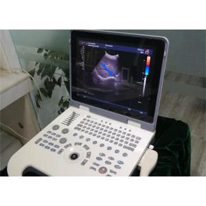 Color Doppler Ultrasound Machine Ultrasound Medical Equipment With 5 Kinds Languages