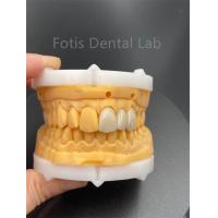 China High Durability Multilayered Zirconia Dental Ceramics For Dental Lab Medical Product on sale