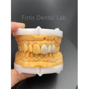 High Durability Multilayered Zirconia Dental Ceramics For Dental Lab Medical Product