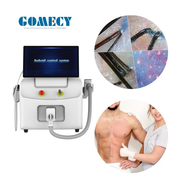 AI Intelligent Skin Analysis System Laser Hair Removal Machine with Adjustable Spot Size and 4 Wave Laser 755 808 940 1064nm
