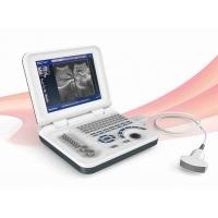 China OEM Diagnostic Ultrasound Machines Digital Ultrasound Scanner Durable on sale