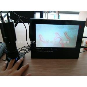 Accurate Color LCD Nailfold Capillary Microcirculation Microscope Device for Sub Health Checking