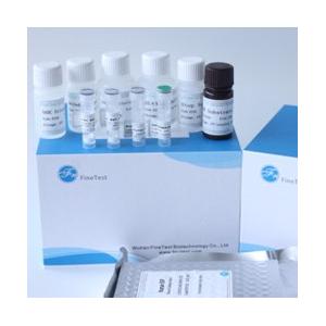 Macrophage Colony Stimulating Factor M-CSF ELISA Kit FDA Approved