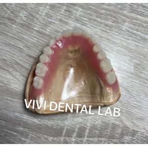 Removable Clear Full Acrylic Denture Retentive Natural Looking