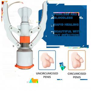 China Medical Grade Plastic Disposable Stapler Circumcision Surgery Device supplier