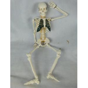Medical Human Body Skeleton Model Demonstrates Green Sternum With Lumbar Disc Herniation