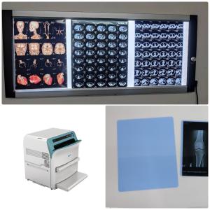 ISO9001 Ct Scan X Ray Film 14x17 Inch Medical Digital X Ray Film
