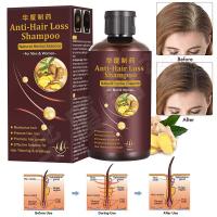China Private Label Hair Loss Shampoo Hair Thickening Shampoo Helps Stop Hair Loss on sale