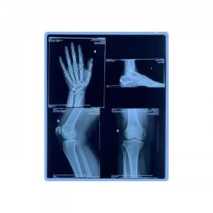 High Contrast Blue X Ray Film With Max Density 3.0D For Detailed Accurate Results
