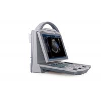 China Video Report Portable Color Doppler Machine Ultrasound Scanner System With 2 Probe Connector on sale