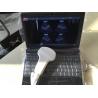 Transvaginal Handheld Ultrasound Scanner With 5 Kinds Of Probe Heads Exchangeabl