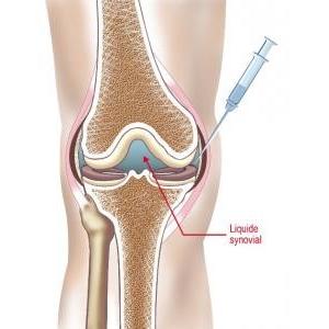 High Purity Medical Sodium Hyaluronate Gel 2.0ml Hyaluronic Acid Osteoarthritis Knee