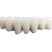 China Beautiful Porcelain Dental Crown Not Easy To Wear Acid And Alkali Resistance on sale