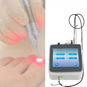 China ​CE Approval 980nm Diode Laser Machine For Nail Fungus Onychomycosis Therapy supplier