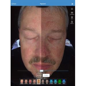 Face Skin Analyzer For Clinic Face Care Test , Facial Skin Analyzer