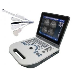 ISO Electron Scan Notebook USG Scan Machine For Obstetrics And Gynecology