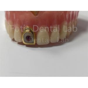 Comfortable Full Acrylic Denture For Professionals Stain / Odor Resistant
