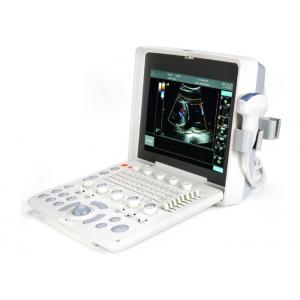 2 Probe Connectors Laptop Ultrasound Scanner Color Doppler Machine With High Resolution