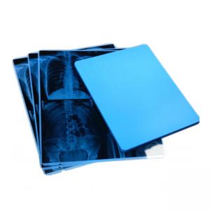China Dt 2b Mri Films For Fuji Agfa Lucky Hq Printer 14x17 Inch Diagnostic Imaging supplier