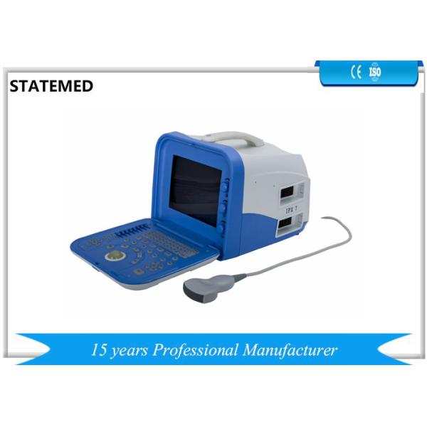 China Máquina da varredura do ultrassom do abdômen, máquina portátil do Sonogram que detecta a profundidade 190mm supplier