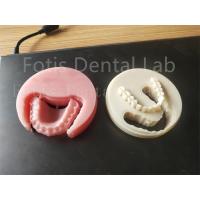 China Comfort Fit Full Acrylic Dental Prosthesis For Professional Technicians Easy To Clean on sale