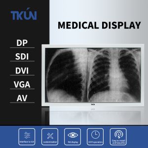China TKUN 23.8/27 Inch High-definition Medical Display Surgical Display Can be Customized SDI Multiple Interfaces 4K Monitor wholesale