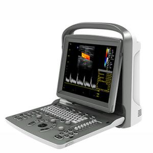 China 12 Inch LED Chison Portable Ultrasound Machine ECO6 With Long Battery Life wholesale