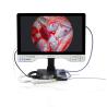 China 15-inch Monitor Mode Selection TUYOU All-in-One Medical Endoscope Camera with Light Source for Urology and Gynecology wholesale