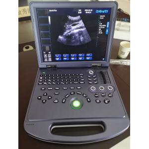 China CE Portable Ultrasonic Diagnostic System 4d Color Doppler Ultrasound 300mm supplier