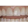 China Adjustable Ceramic Porcelain Fused To Metal Dental Teeth With High Strength / Intensity wholesale