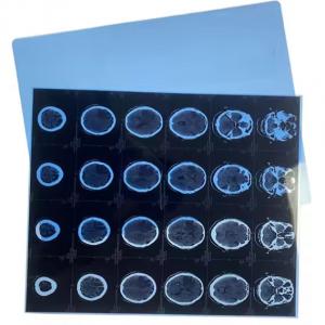 8*10 Thermal Medical X Ray Film For Fuji Film High Contrast