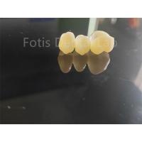 China Dental Industry Zirconia Layered With Porcelain Long Lasting Solution on sale