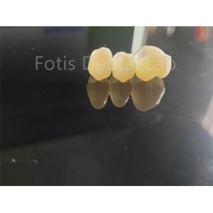 Dental Industry Zirconia Layered With Porcelain Long Lasting Solution