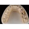 China Sandblasted Single Tooth Implant With Self Tapping Thread And Internal Hex Connection wholesale