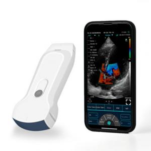 Portable IPad Wireless Ultrasound Probe For Clinical Diagnosis