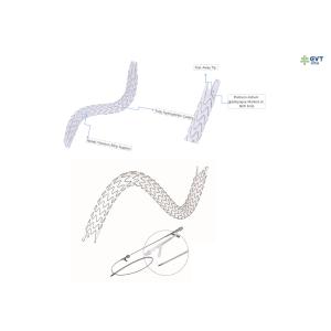 China Stent uretral de gran calibre y lúmen, diseño hidrofóbico de nitinol para una colocación precisa wholesale