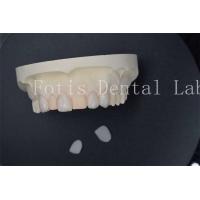 China Custom Artificial Dental Lab Veneers With Superior Stain Resistance on sale