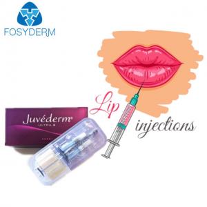 China Juvederm Ultra 3 Hyaluronic Acid Dermal Filler For Face Lips supplier