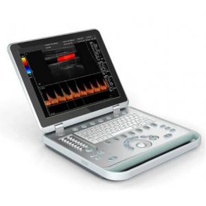 color 3D ultrasound machine cheap laptop portable ultrasound machine C5