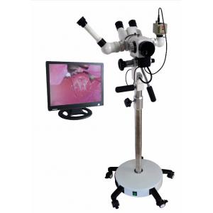Medical Digital Gynecologic Examination Colposcope/Obstetrics & Gynecology Equipments/women examination