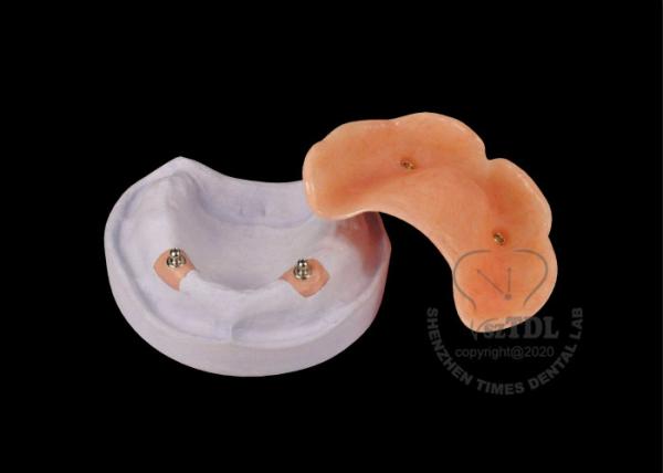 Detachable Precision Attachment Denture Scop Attachment