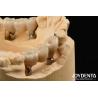 China Zirconia Implants Perfect Match With Natural Teeth Zero Allergy Risk wholesale