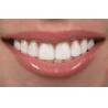 China Interproximal Tight Cosmetic Dental Veneers For Teeth Health With IPS Ceramic Material wholesale