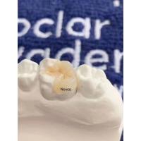 China Dental Composite Inlays And Onlays Ivoclar Nexco High Esthetics on sale